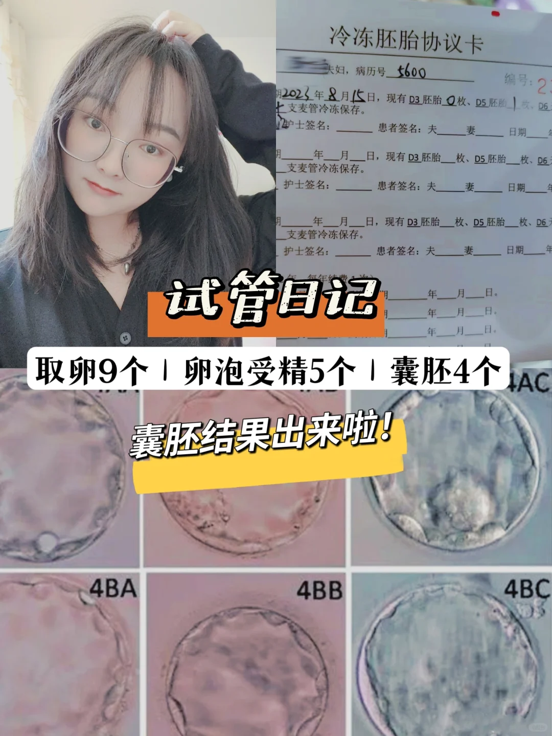 试管日记｜一分钟教会你看胚胎等级‼️,代孕最专业机构